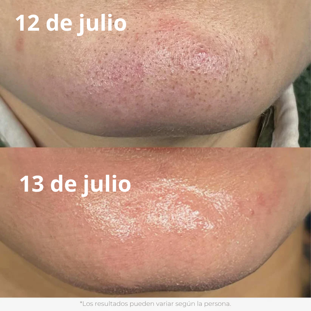 Nuaré. – Duo Glow de Arroz Fermentado