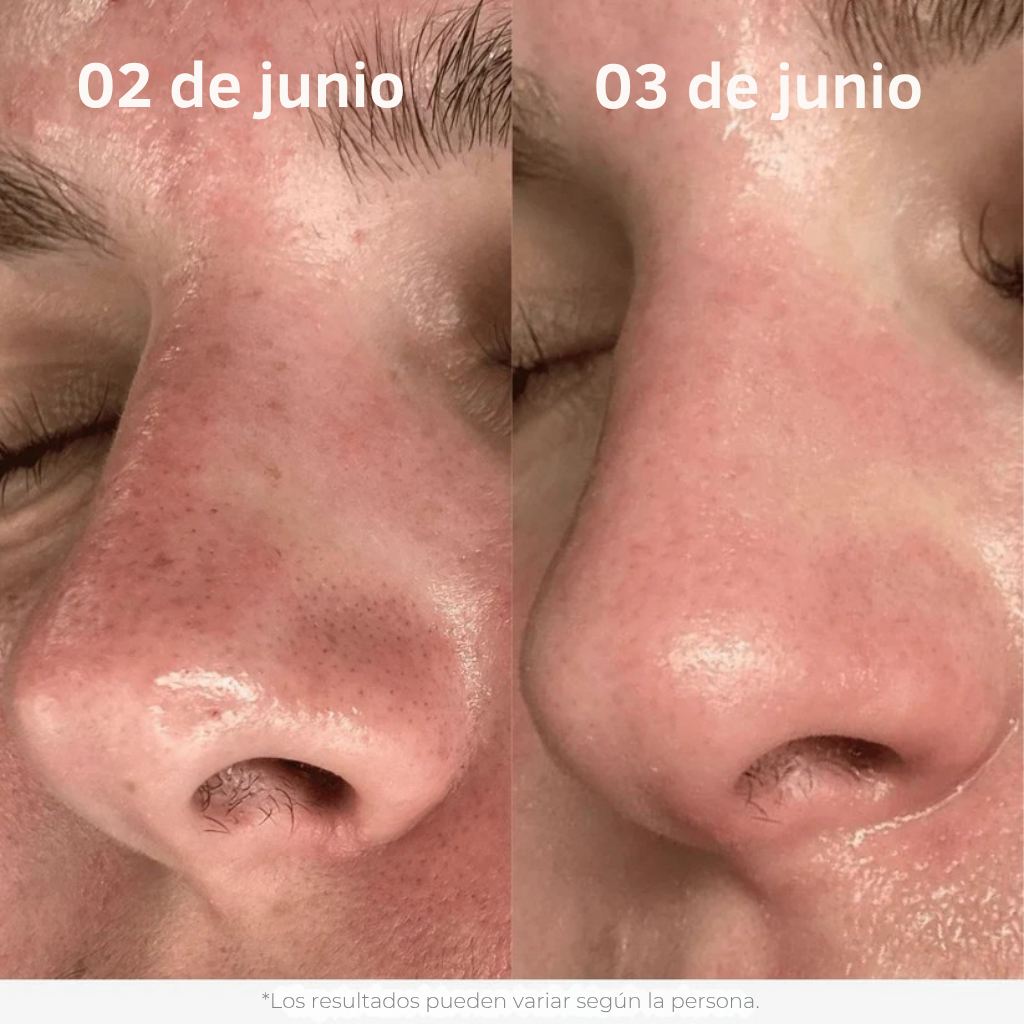 Nuaré. – Duo Glow de Arroz Fermentado