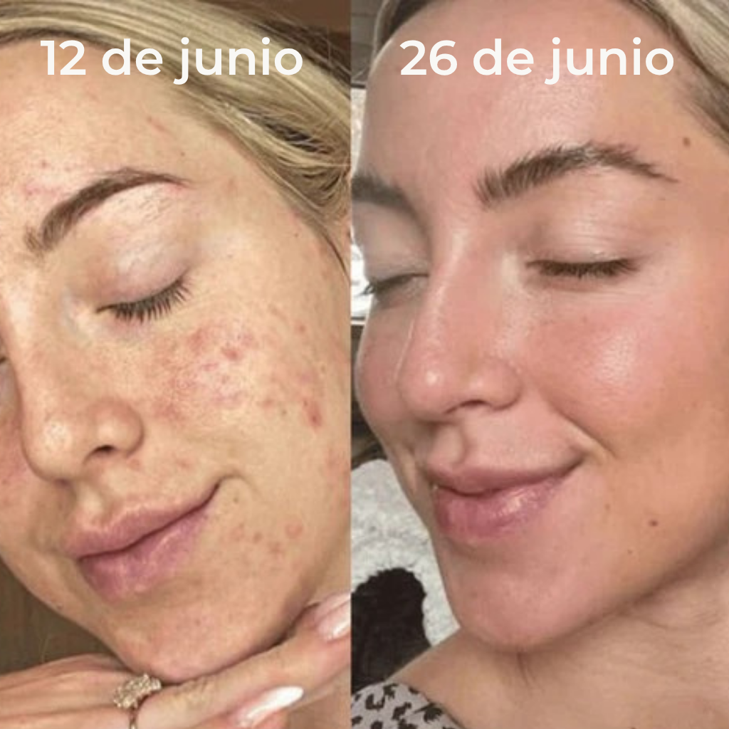 Nuaré. – Duo Glow de Arroz Fermentado